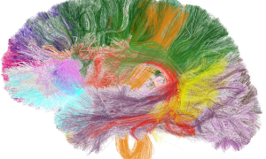 cerveau coloré